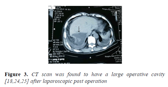 microbiology-operative-cavity