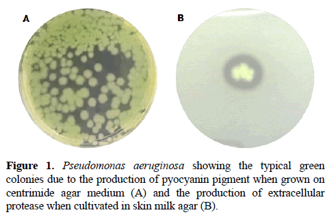 microbiology-production-extracellular