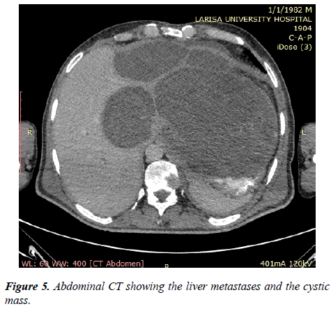 molecular-oncology-Abdominal-CT