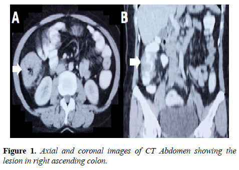 molecular-oncology-Axial-coronal