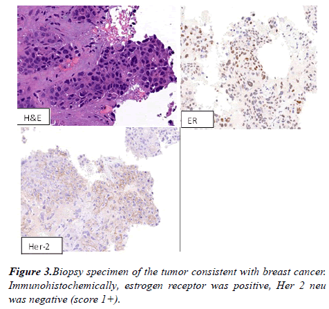 molecular-oncology-Biopsy-specimen