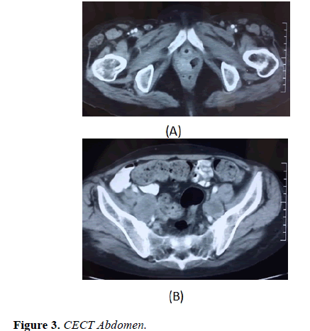 molecular-oncology-CECT-Abdomen