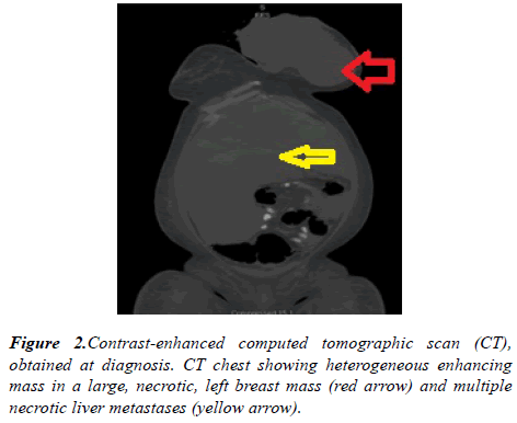 molecular-oncology-Contrast-enhanced