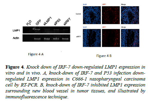 molecular-oncology-LMP1-expression