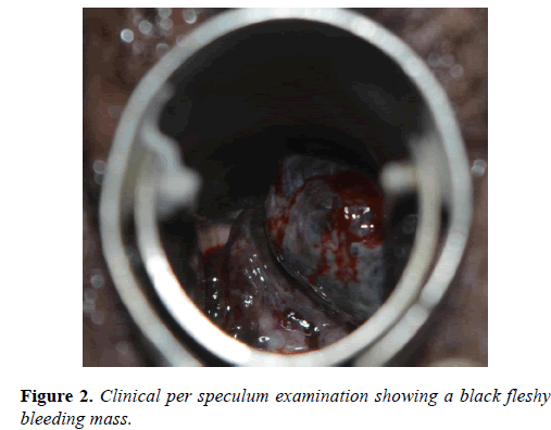 molecular-oncology-bleeding-mass