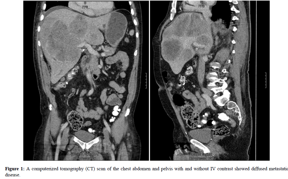 molecular-oncology-computerized-tomography