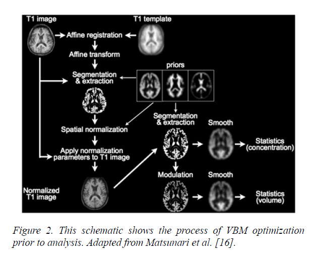 neuroinformatics-neuroimaging-VBM-optimization