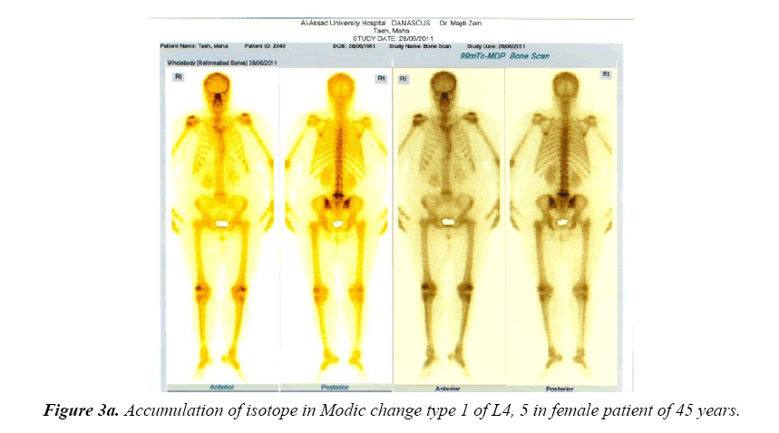 neuroinformatics-neuroimaging-accumulation-isotope