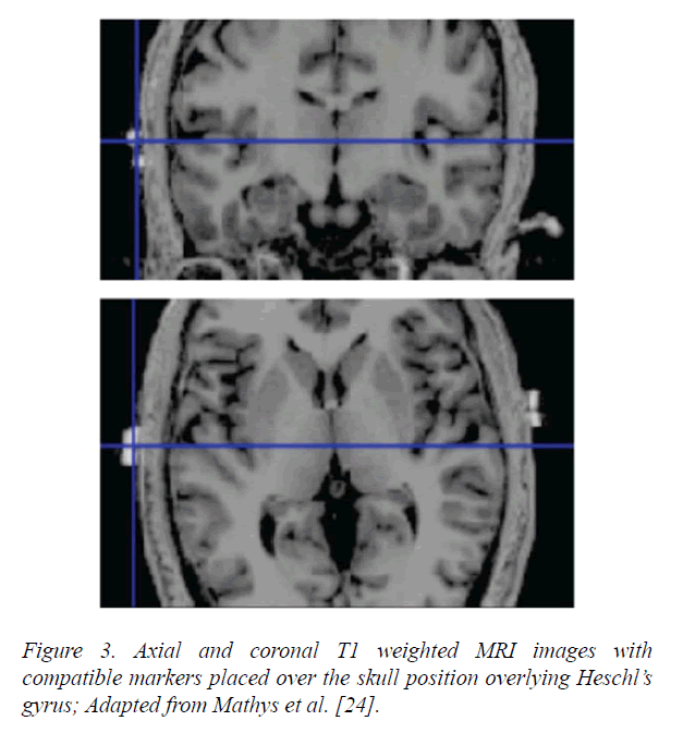 neuroinformatics-neuroimaging-compatible-markers