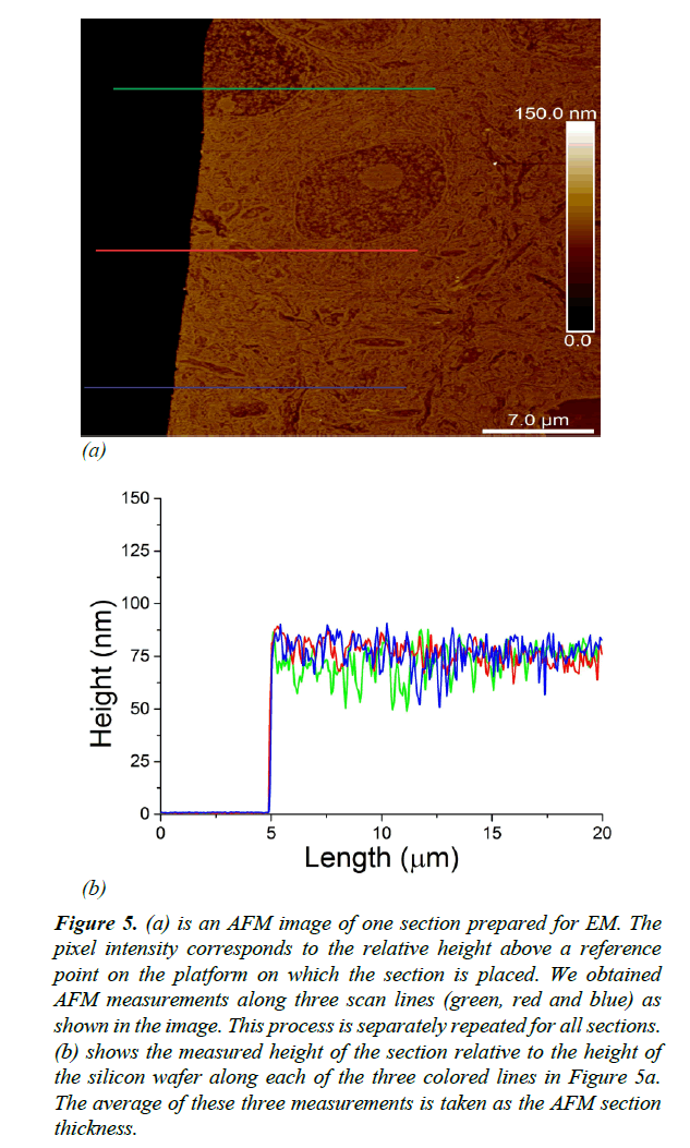 neuroinformatics-neuroimaging-intensity-corresponds