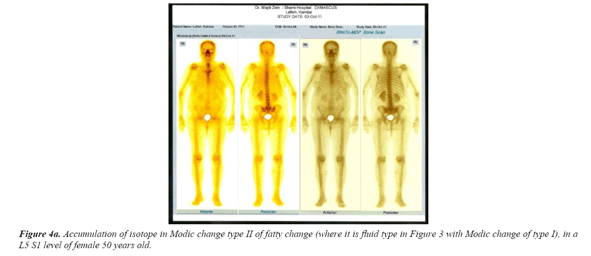 neuroinformatics-neuroimaging-modic-change