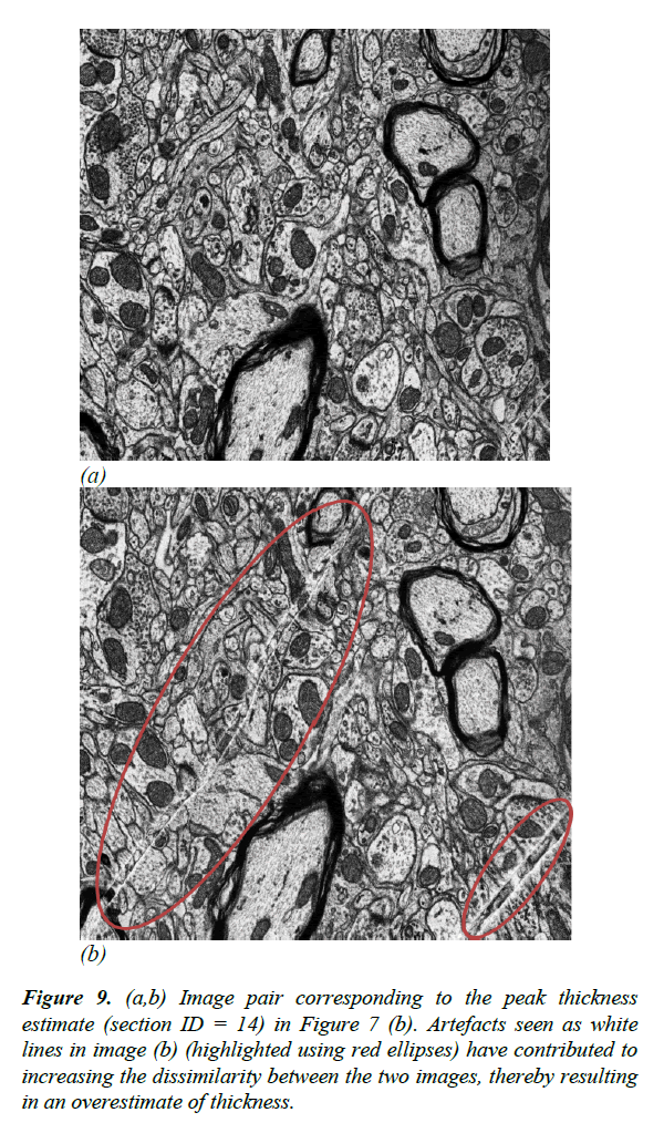 neuroinformatics-neuroimaging-overestimate-thickness