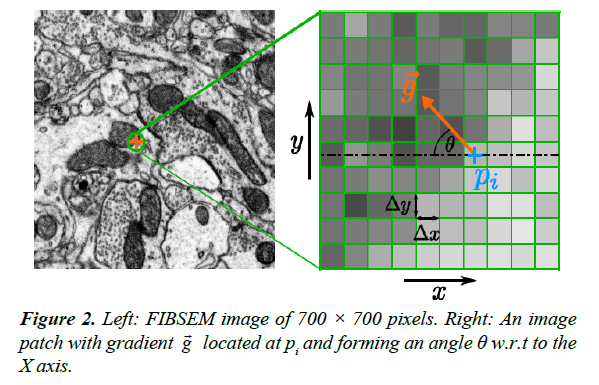 neuroinformatics-neuroimaging-patch-gradient