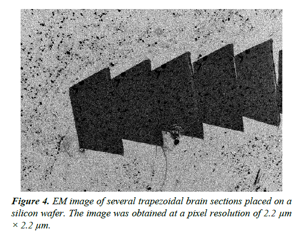 neuroinformatics-neuroimaging-trapezoidal-brain