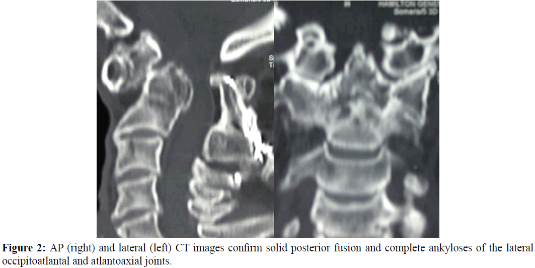 neurology-neurorehabilitation-research-confirm-solid-posterior