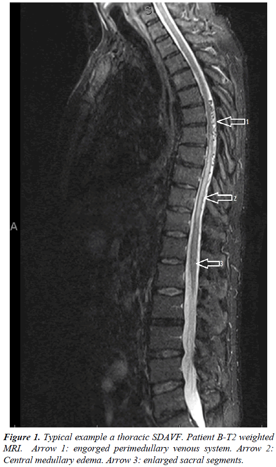 neurology-neurorehabilitation-research-thoracic-Patient-engorged