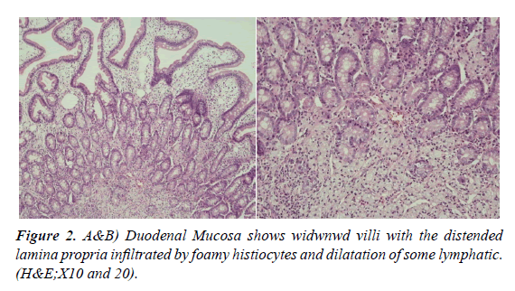 nutrition-human-health-Duodenal-Mucosa