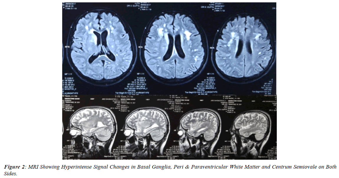 ophthalmic-and-eye-research-Basal-Ganglia