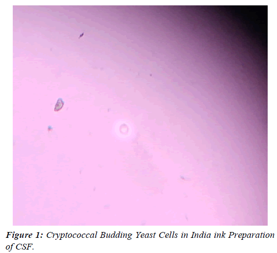 ophthalmic-and-eye-research-Cryptococcal-Budding