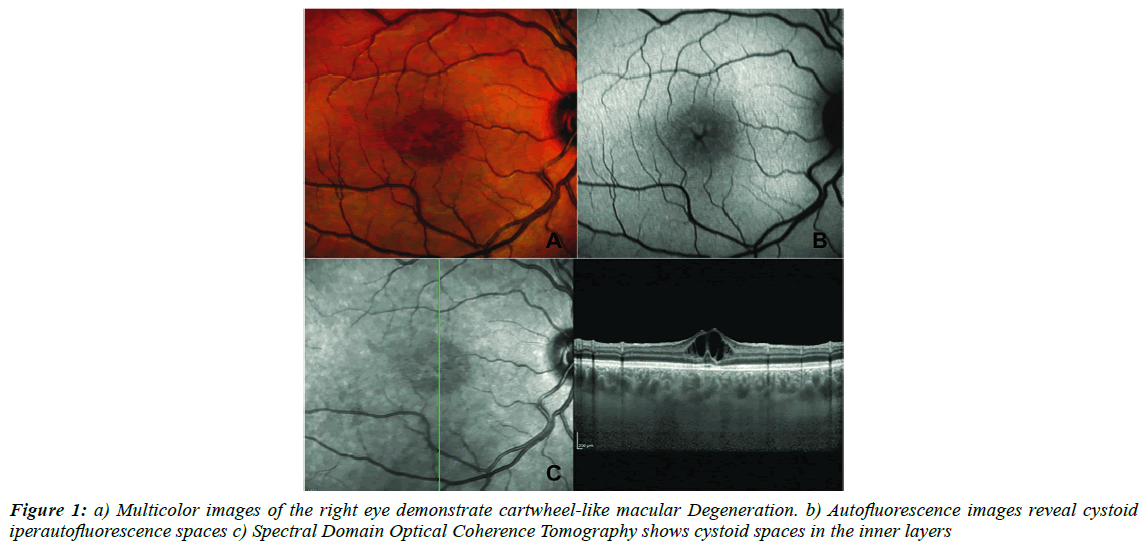 ophthalmic-and-eye-research-Multicolor-images