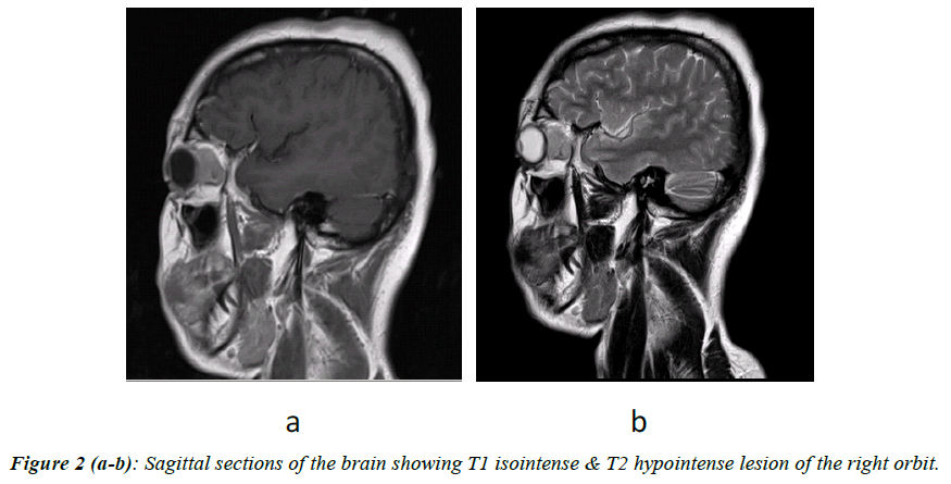 ophthalmic-and-eye-research-Sagittal-sections