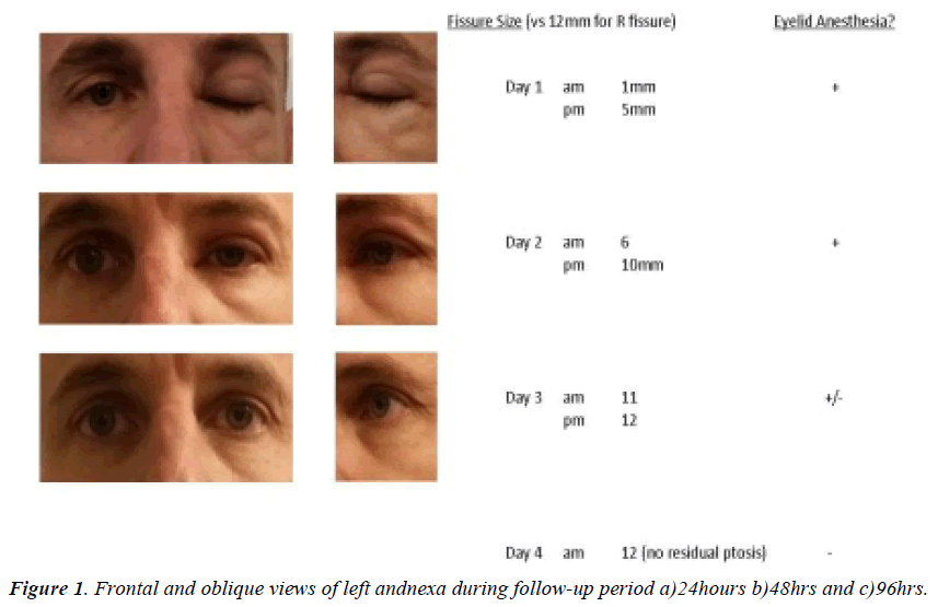 ophthalmic-and-eye-research-andnexa-during