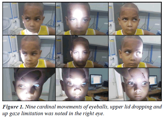 ophthalmic-and-eye-research-cardinal-movements