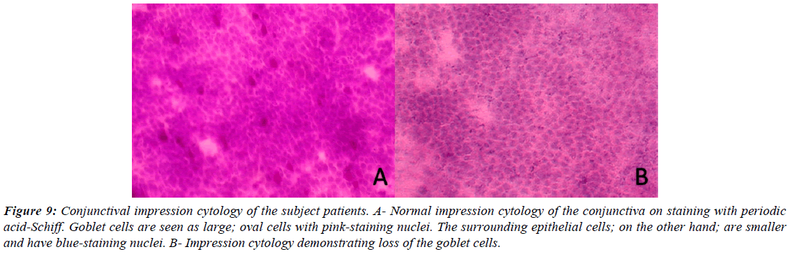 ophthalmic-and-eye-research-goblet-cells