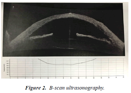 ophthalmic-and-eye-research-ultrasonography