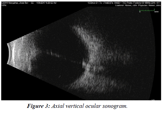 ophthalmic-and-eye-research-vertical-ocular