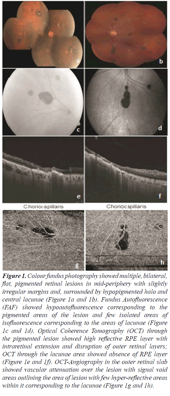 ophthalmic-eye-research-Colour-fundus