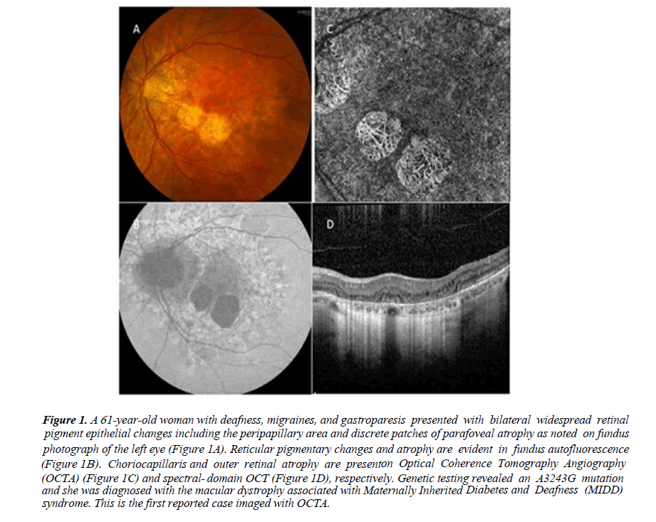 ophthalmic-eye-research-Optical-Coherence