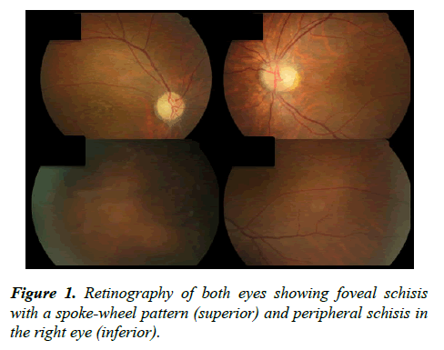 ophthalmic-eye-research-Retinography