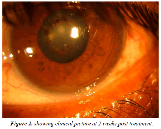 ophthalmic-eye-research-clinical-picture