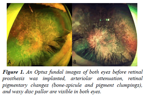 ophthalmic-eye-research-fundal