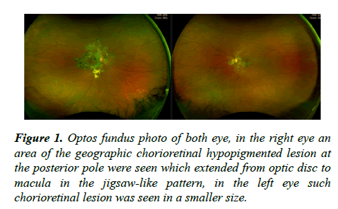 ophthalmic-eye-research-fundus