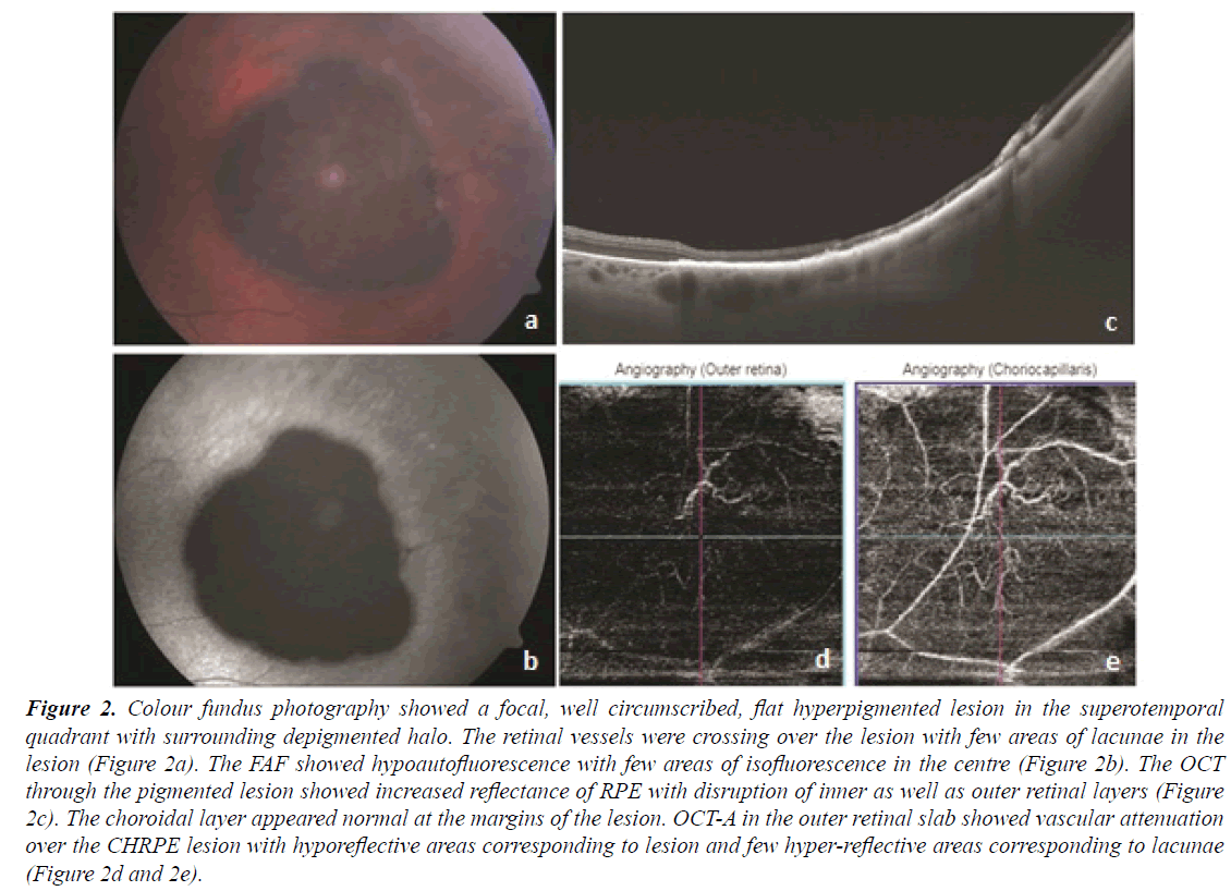 ophthalmic-eye-research-fundus-photography