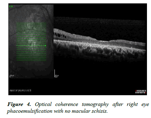 ophthalmic-eye-research-macular