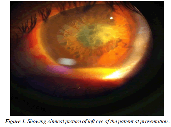 ophthalmic-eye-research-patient-presentation