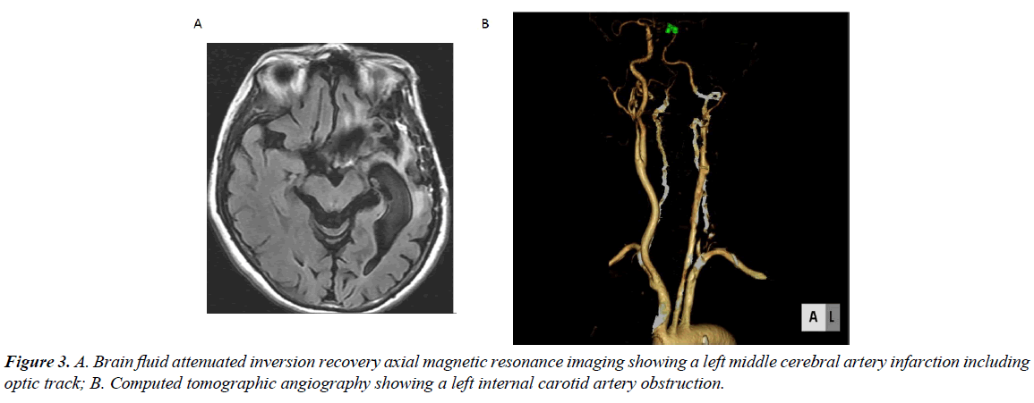 ophthalmic-eye-research-recovery-axial-magnetic