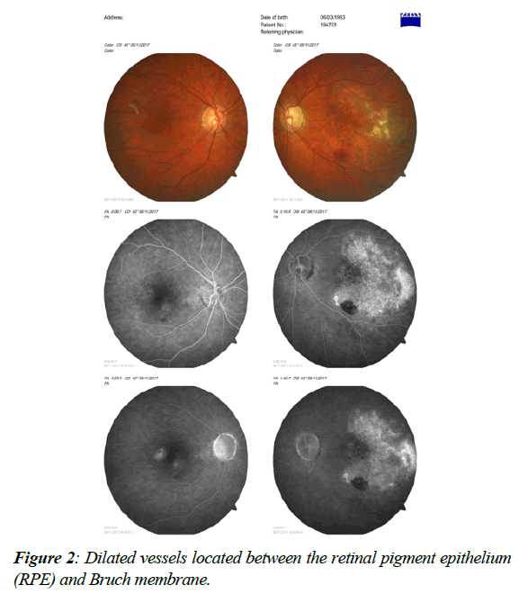 ophthalmic-eye-research-retinal-pigment