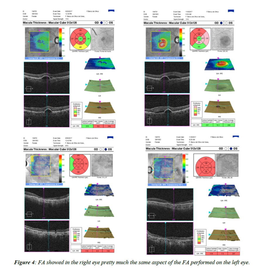 ophthalmic-eye-research-right-eye-pretty