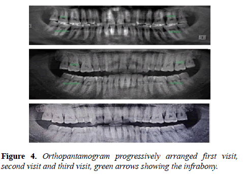 oral-medicine-and-toxicology-Orthopantamogram