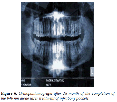 oral-medicine-and-toxicology-diode-laser