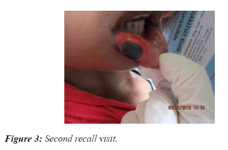 oral-medicine-toxicology-Second-recall