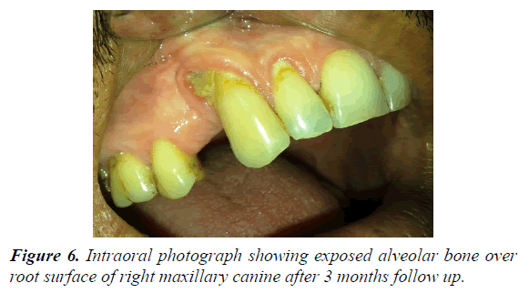 oral-medicine-toxicology-alveolar-bone