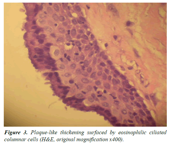 oral-medicine-toxicology-columnar-cells