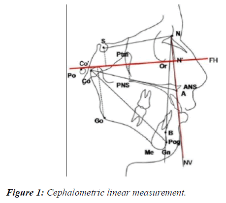 oral-medicine-toxicology-linear-measurement