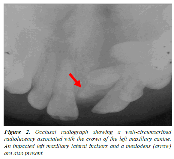 oral-medicine-toxicology-maxillary-canine