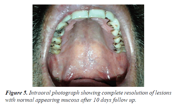 oral-medicine-toxicology-normal-appearing